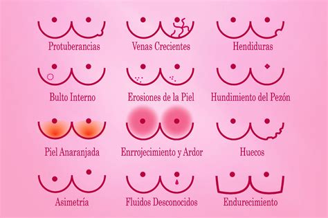 Cáncer de mama en Sonora: ¿Qué es el cáncer de mama?