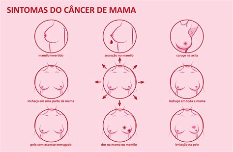 Câncer de Mama Saúde em primeiro lugar | Policlínica ...