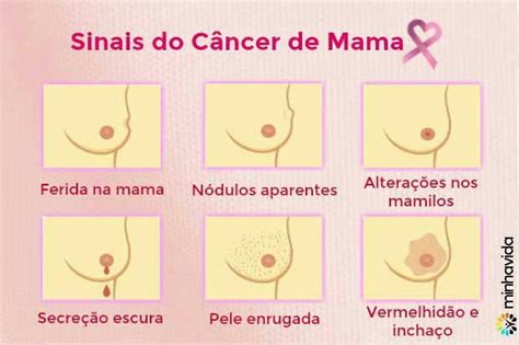 Câncer de mama: sintomas, tratamentos e causas | Minha Vida