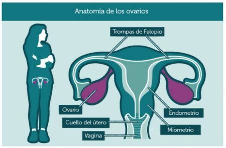 Cáncer de Ovario: 10 claves   iTAcC