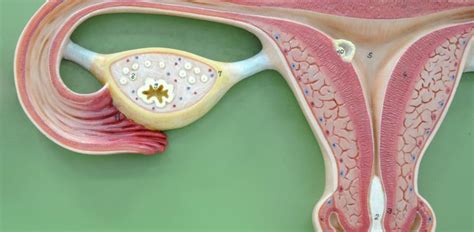 Cáncer de ovario Causas, síntomas y tratamiento