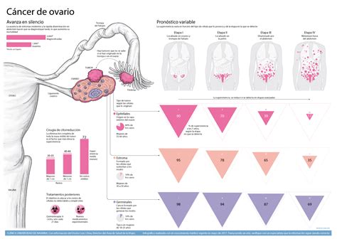 Cáncer de Ovario: síntomas, tipos, estadios y tratamiento ...