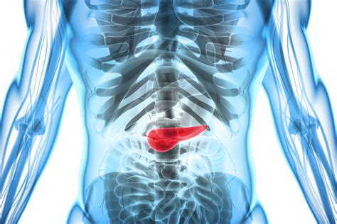 Câncer de pâncreas: os sintomas que podem passar ...