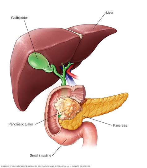 Cáncer de páncreas Síntomas y causas Mayo Clinic