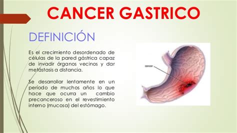 Cancer de piel y cancer gastrico  1