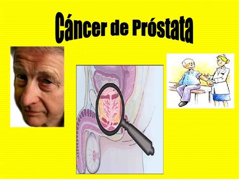 Cancer De Prostata