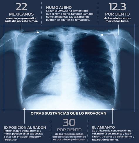 Cáncer de pulmón, el más mortal para 2020