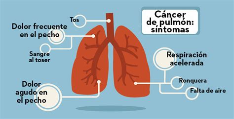 Cáncer de pulmón en no fumadores   Diabetes, bienestar y salud