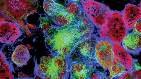 Cancer | Science | AAAS