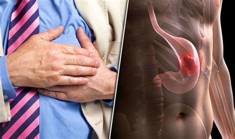 Cancer symptoms: Heartburn is sign of deadly stomach ...