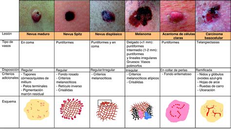 canceres de piel | Dermatology | Pinterest