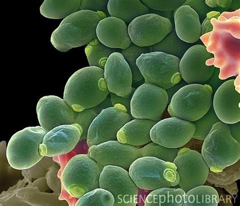 Candida albicans yeast cells. Coloured scanning electron ...