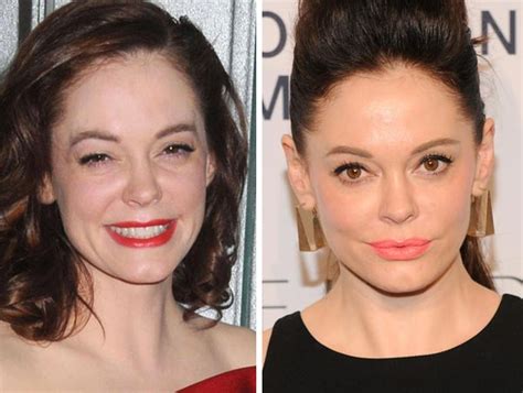 Car Accident: Rose Mcgowan Car Accident Before And After