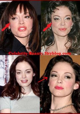 Car Accident: Rose Mcgowan Car Accident Pictures 2007