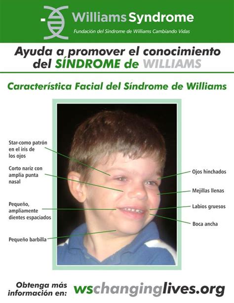 Características faciales infografía en Español. Visita www ...