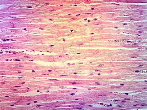 Cardiac Muscle Tissue; uninucleated cells and nuclei are ...