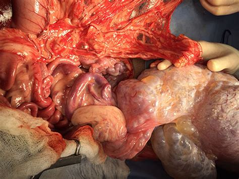 Case Study | Teratoma: A Rare but Invasive Tumor | Animal ...