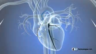 Cateterismo cardiaco. Pacientes   YouTube