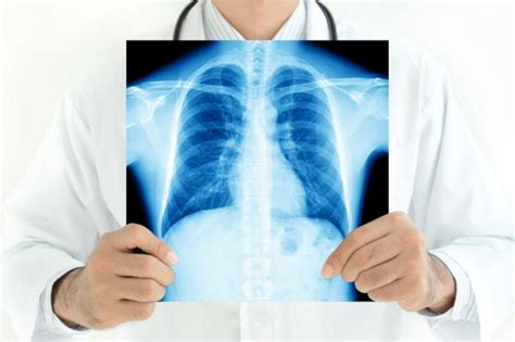 Causas de las manchas en los pulmones