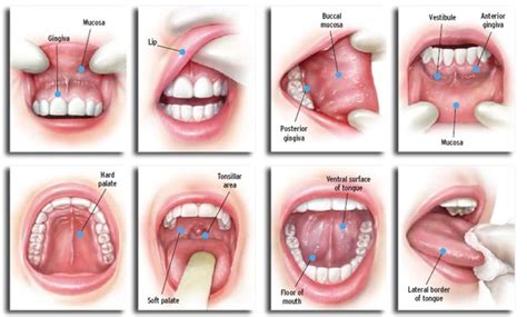 Causes, Remedies and Prevention of Palate Cancer | St ...
