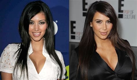 Celebrities y cirugía estética: el antes y después | Blog ...