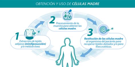 Células Madre | Clinica del Deporte – Dr. Esteban Santos