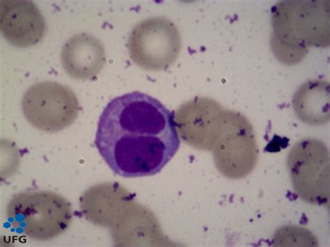 células sanguineas: noviembre 2014