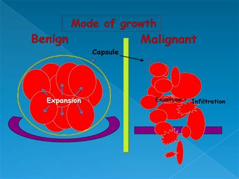 Characteristics of benign and malignant neoplasms