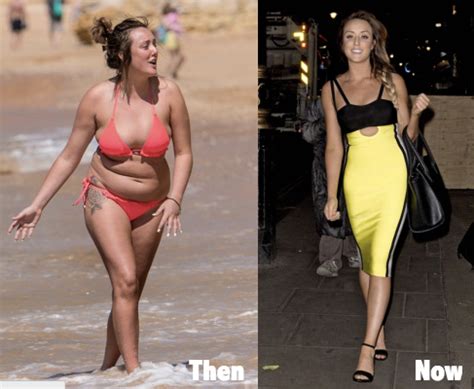 Charlotte Crosby Plastic Surgery Before and After Nose Job