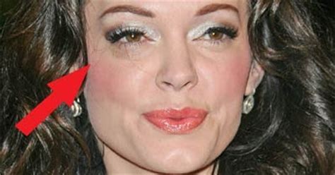 Chatter Busy: Rose McGowan Accident