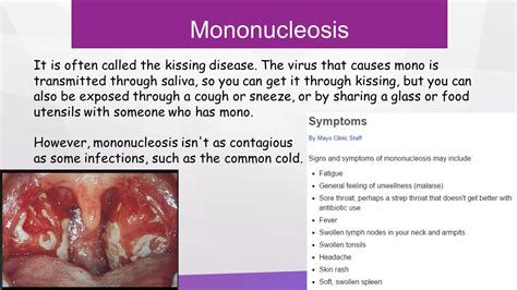 Childhood Diseases – On a Mission to Educate: Infectious ...