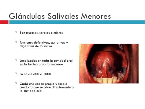 Clase de glandulas salivales en ORL