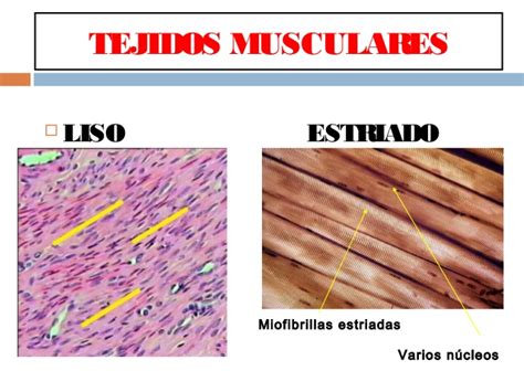 Clase de tejido muscular 2013