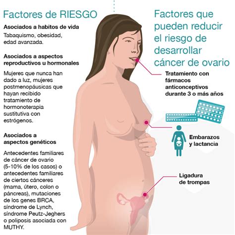 Claves y prioridades del cáncer de ovario en España ...