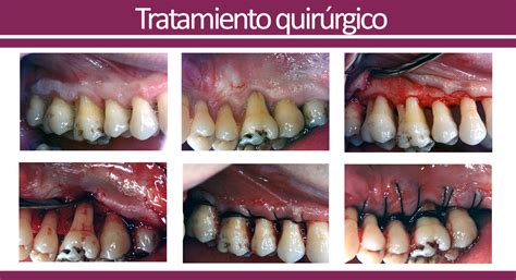 Clínica de periodoncia Cristina Jerez | Tratamientos