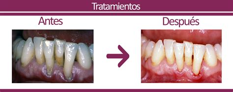 Clínica de periodoncia Cristina Jerez | Tratamientos