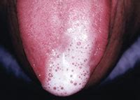 Clinical Conditions and Lesions Mimicking Salivary Gland ...