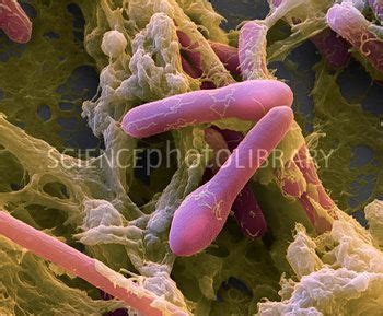 Clostridium botulinum bacteria, SEM | SEM | Pinterest ...