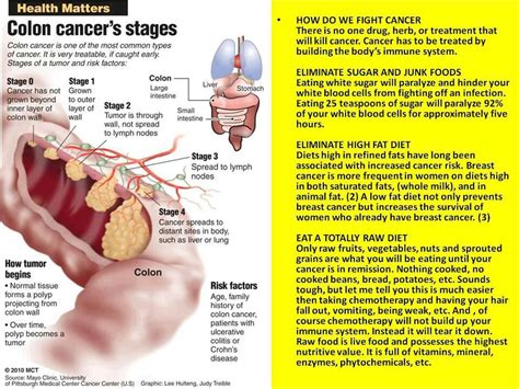 Colon Cancer | Colon Cancer Awareness | Pinterest