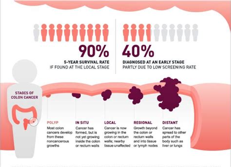 Colon Cancer Early Symptoms: What Are the Early Signs?