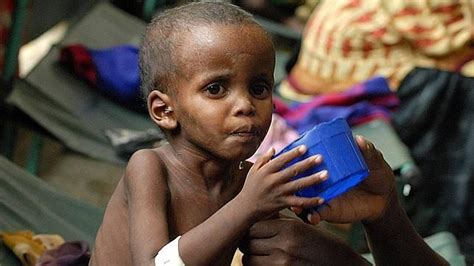 Combate la desnutrición infantil en el mundo
