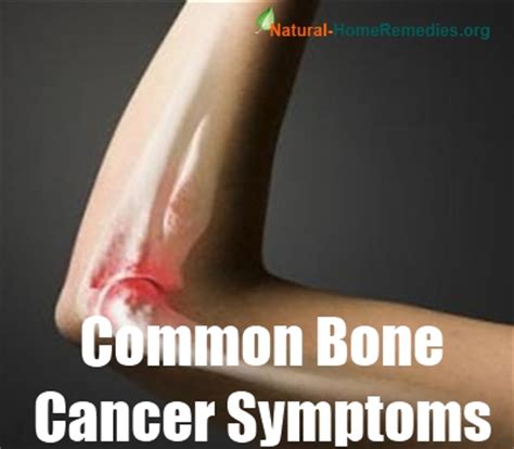 Common Bone Cancer Symptoms   How To Recognize Bone Cancer ...