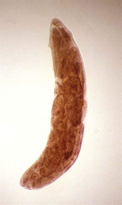 Common Intestinal Parasites In Humans Pictures to Pin on ...