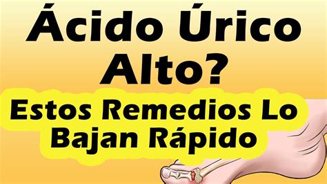 COMO BAJAR EL ACIDO URICO RAPIDO Remedios Naturales Para ...