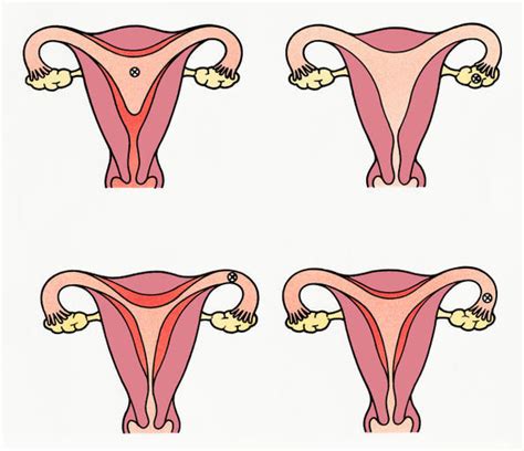 Cómo es el ciclo menstrual de la mujer