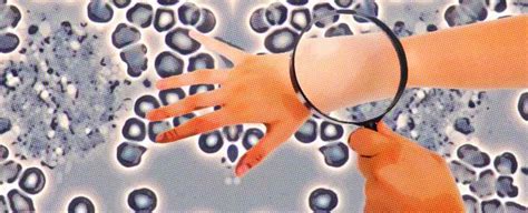 ¿Cómo prevenir y curar hongos en la piel? Datos y consejos