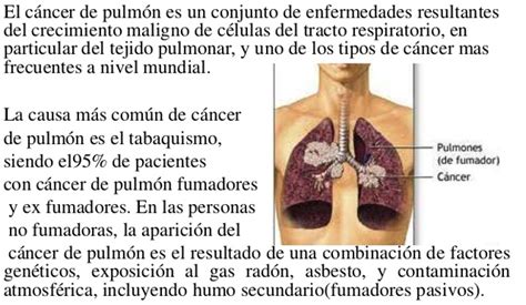 Conoce los síntomas del cáncer de pulmón | digo:portal