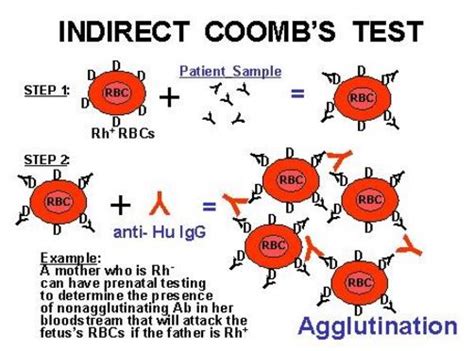 Coombs Test   Direct, Indirect, Positive, Negative Results