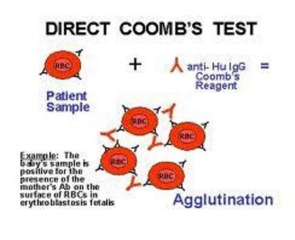 Coombs Test   Direct, Indirect, Positive, Negative Results