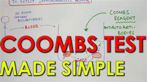 Coombs Test Made Simple   YouTube | PA | Pinterest